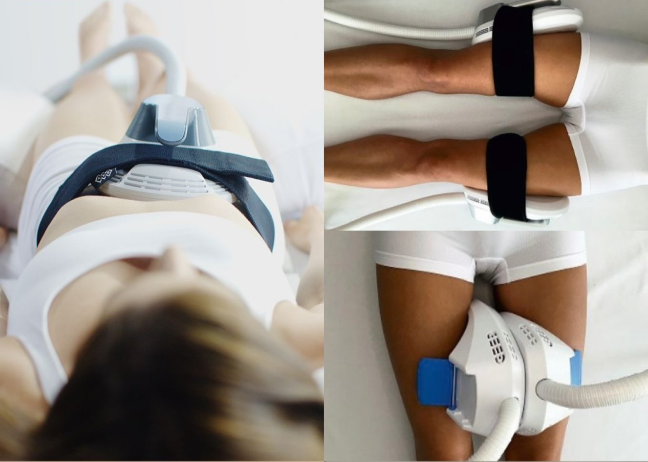 EMShape BodySculpt
